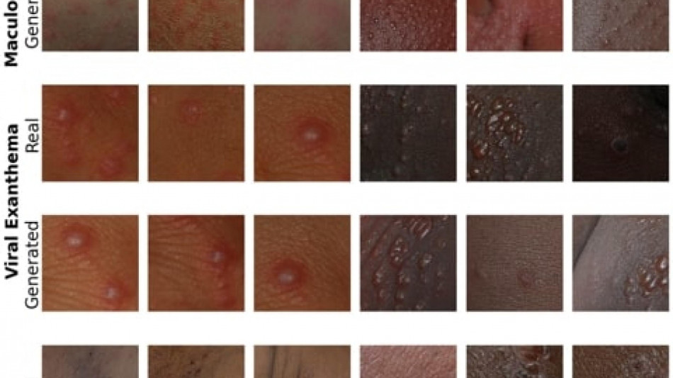 Malattie pelle, da UniBo Ai più equa per diagnosi più inclusiva