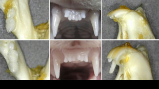Des chercheurs japonais travaillent sur un m&eacute;dicament faisant repousser les dents