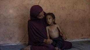 Fonti mediche, 19 palestinesi morti di fame in 24 ore