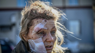 The Ukraine war in 10 iconic pictures