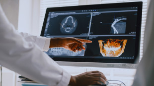 Staminali a gel rigenerano ossa e gengive, impianti più rapidi