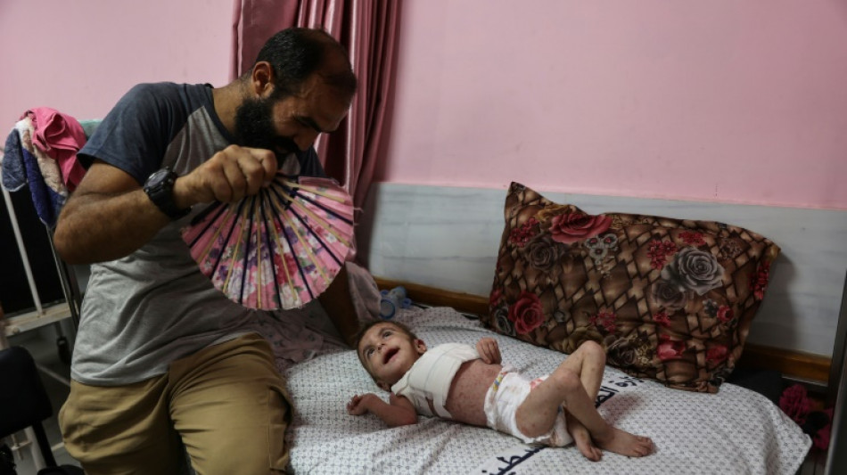 Sarna e piolho se propagam nas crian&ccedil;as em Gaza 